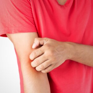 Dermatologie
