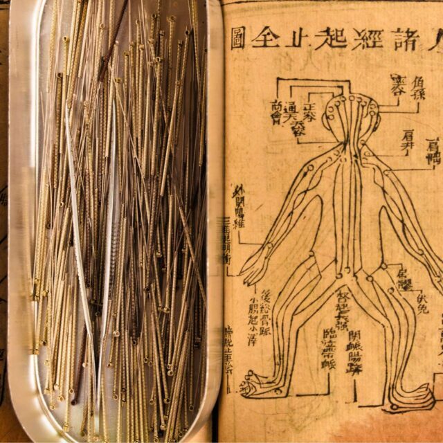 Acupuncture-francois-malaise-web (4)