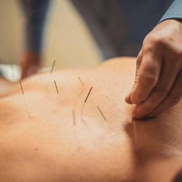 Acupuncture-francois-malaise-web (5)
