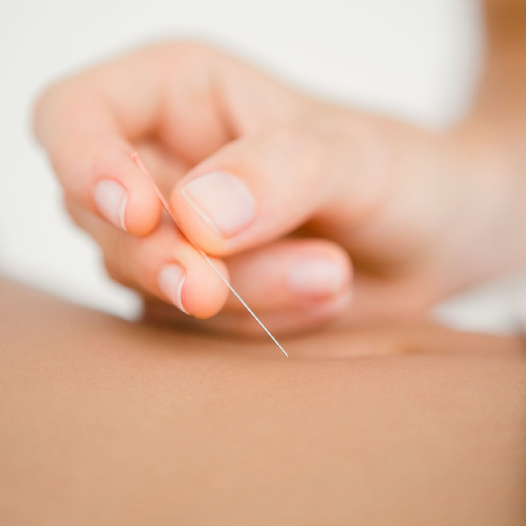 acupuncture-francois-malaise-